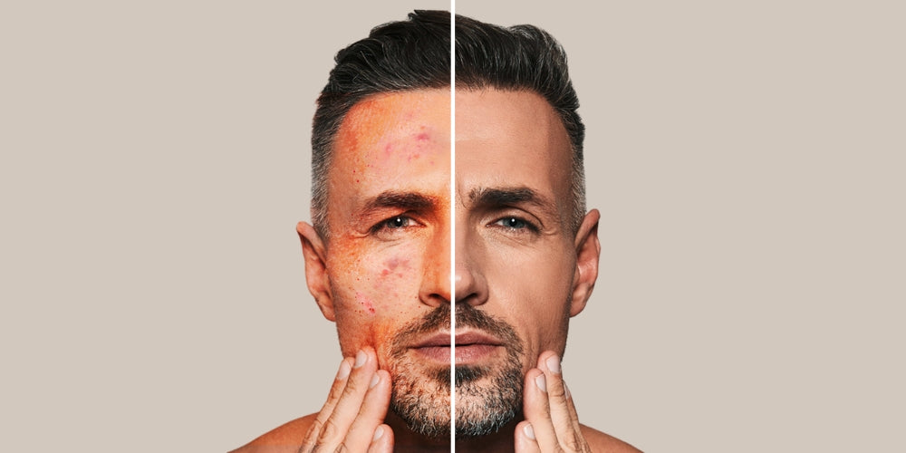 10 Reasons Your Face Is Red - Guide For Men & VITAMAN USA