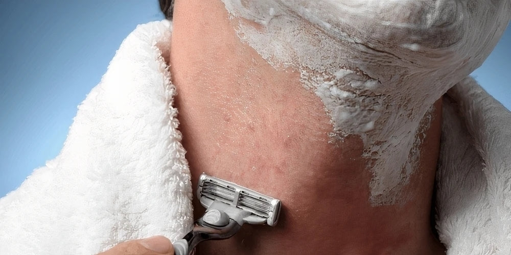 how to treat razor burn men blog vitaman