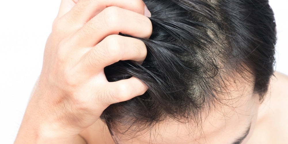 what causes itchy scalp
